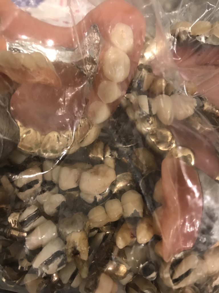 Zahngold verkaufen