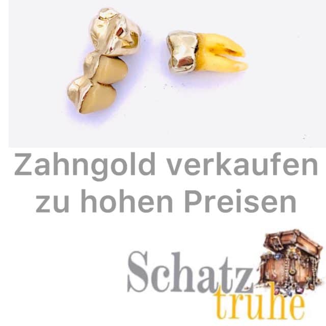 Zahngold Ankauf Goldzähne kaufen wir an Bargeld sofort!