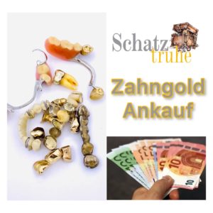 Wo kann man am besten Gold verkaufen? 3 Zahngold verkaufen